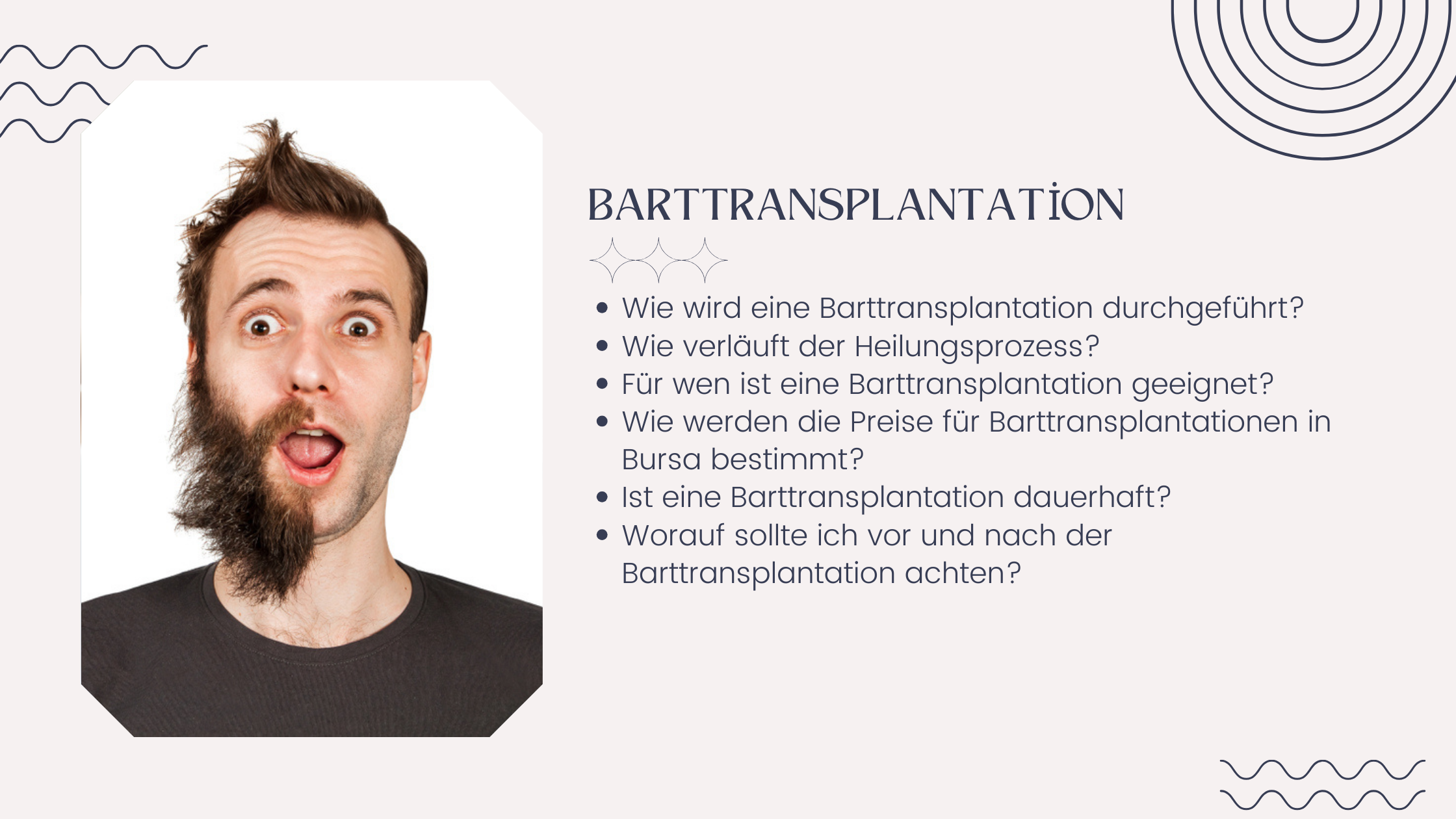 Barttransplantation